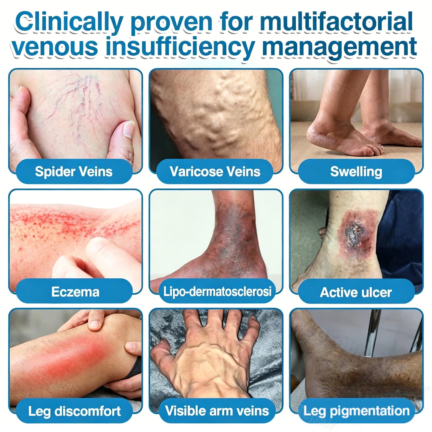 🇨🇦🏆✅️🏃Femscoop® VeinRepair Microneedle Patch Roll⚡Instant Relief, Long-Term Results