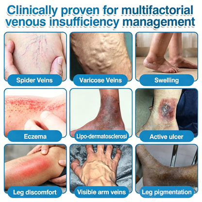 🇨🇦🏆✅️🏃Femscoop® VeinRepair Microneedle Patch Roll⚡Instant Relief, Long-Term Results