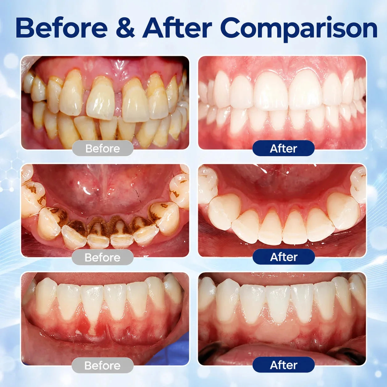 Femscoop® BeeTakt Oral Repair Solution – Anti-Plaque, Stain Removal & Cavity Care