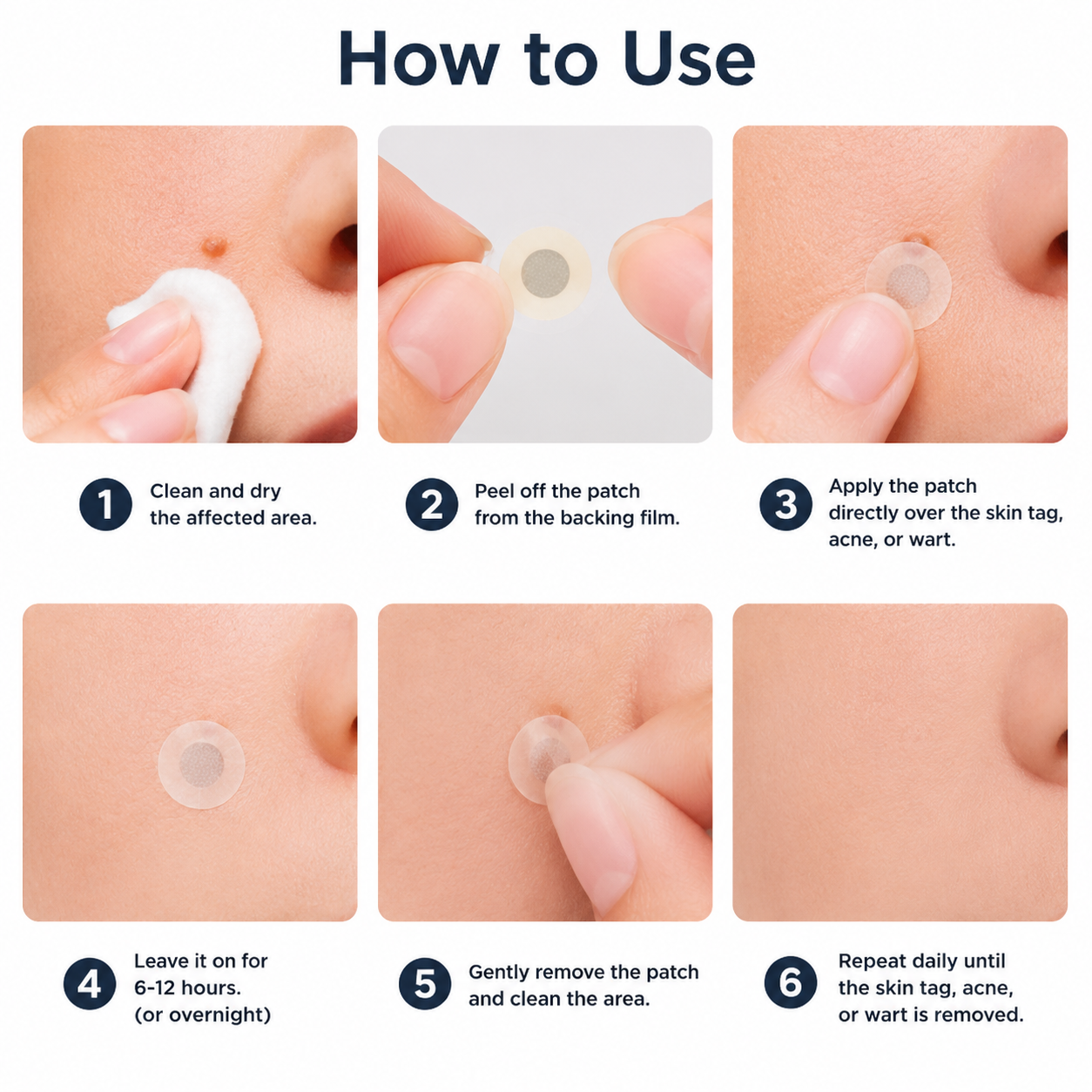 MYLUREN™2-in-1 Microneedle & Hydrocolloid Patch🍀| Removes Raised Moles, Acne, Flat Warts & Skin Tags | Helps Improve Wrinkles, Scars & Blemishes | Invisible Patches for Face & Body