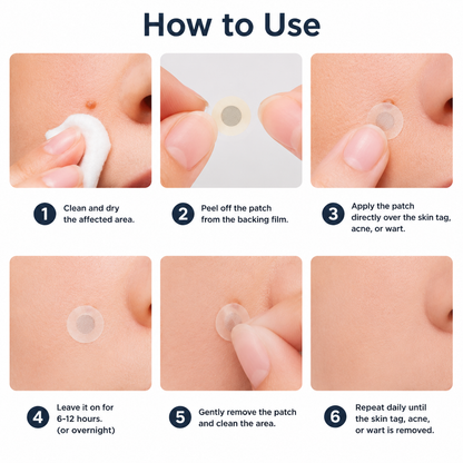 MYLUREN™2-in-1 Microneedle & Hydrocolloid Patch🍀| Removes Raised Moles, Acne, Flat Warts & Skin Tags | Helps Improve Wrinkles, Scars & Blemishes | Invisible Patches for Face & Body