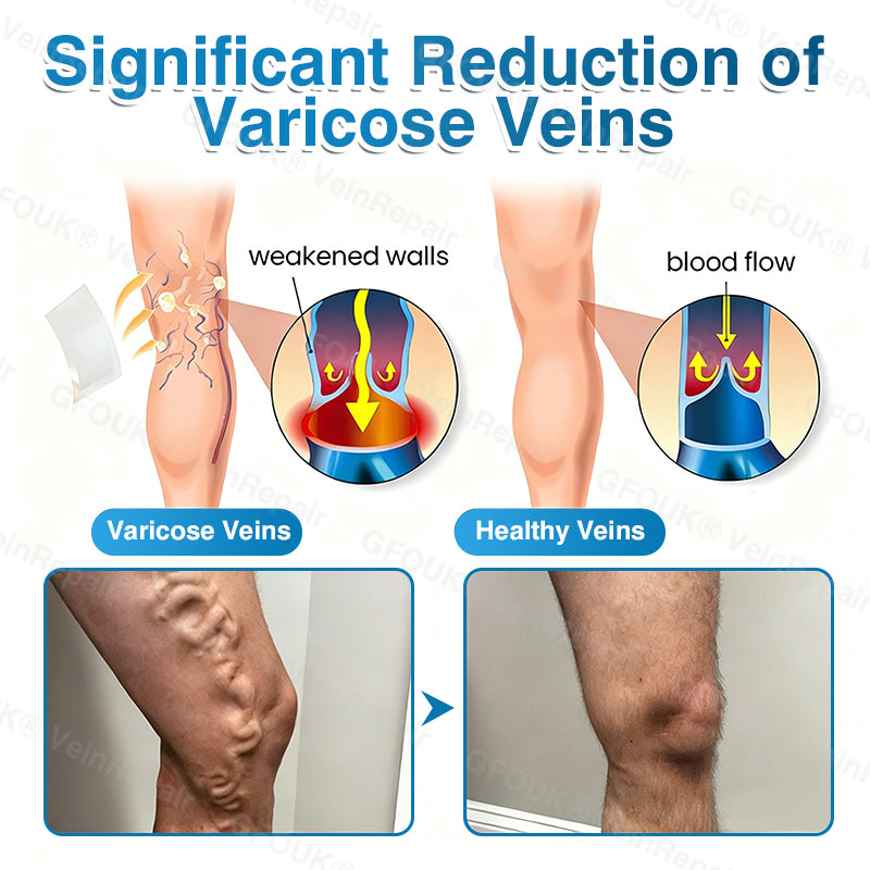 🇨🇦🏆✅️🏃Femscoop® VeinRepair Microneedle Patch Roll⚡Instant Relief, Long-Term Results