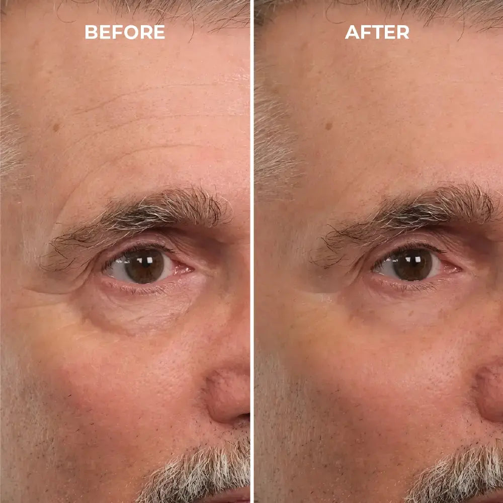Femscoop Rapid Reduction Serum: Banish Heavy Eye Bags and Fine Lines in 10 Minutes Flat