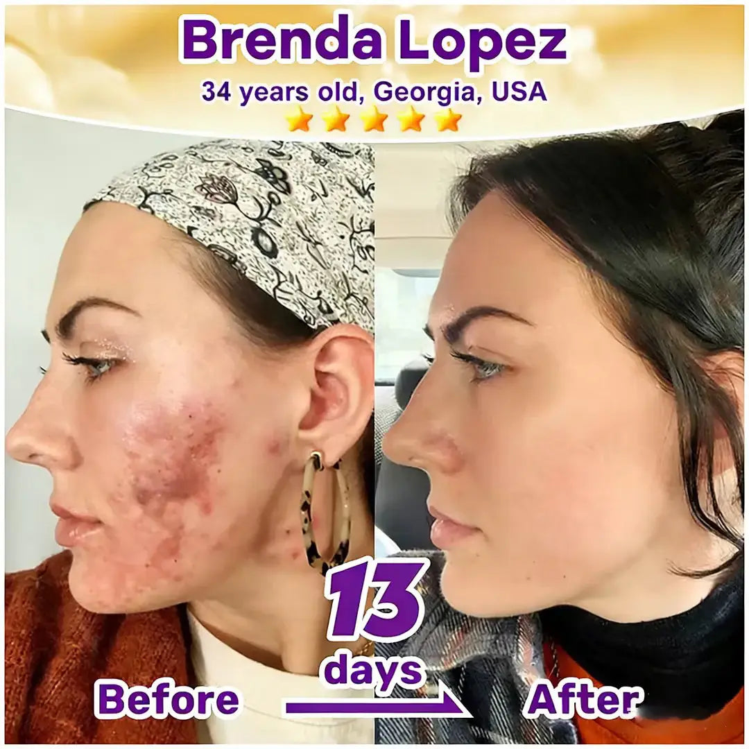 Femscoop® Biotin 10-in-1 Skin Restoration Cream