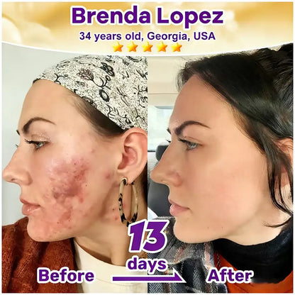 Femscoop® Biotin 10-in-1 Skin Restoration Cream