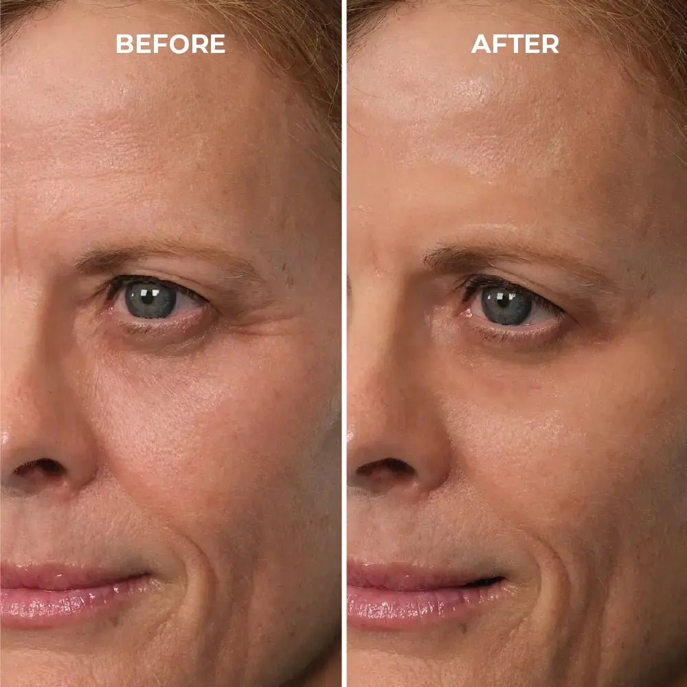 Instantly Erase Heavy Eye Bags & Dark Circles: Look Years Younger in Just 10 Minutes with Femscoop