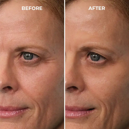 Instantly Erase Heavy Eye Bags & Dark Circles: Look Years Younger in Just 10 Minutes with Femscoop