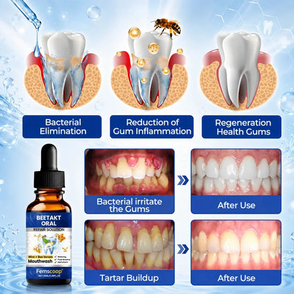 Femscoop® BeeTakt Oral Repair Solution – Anti-Plaque, Stain Removal & Cavity Care