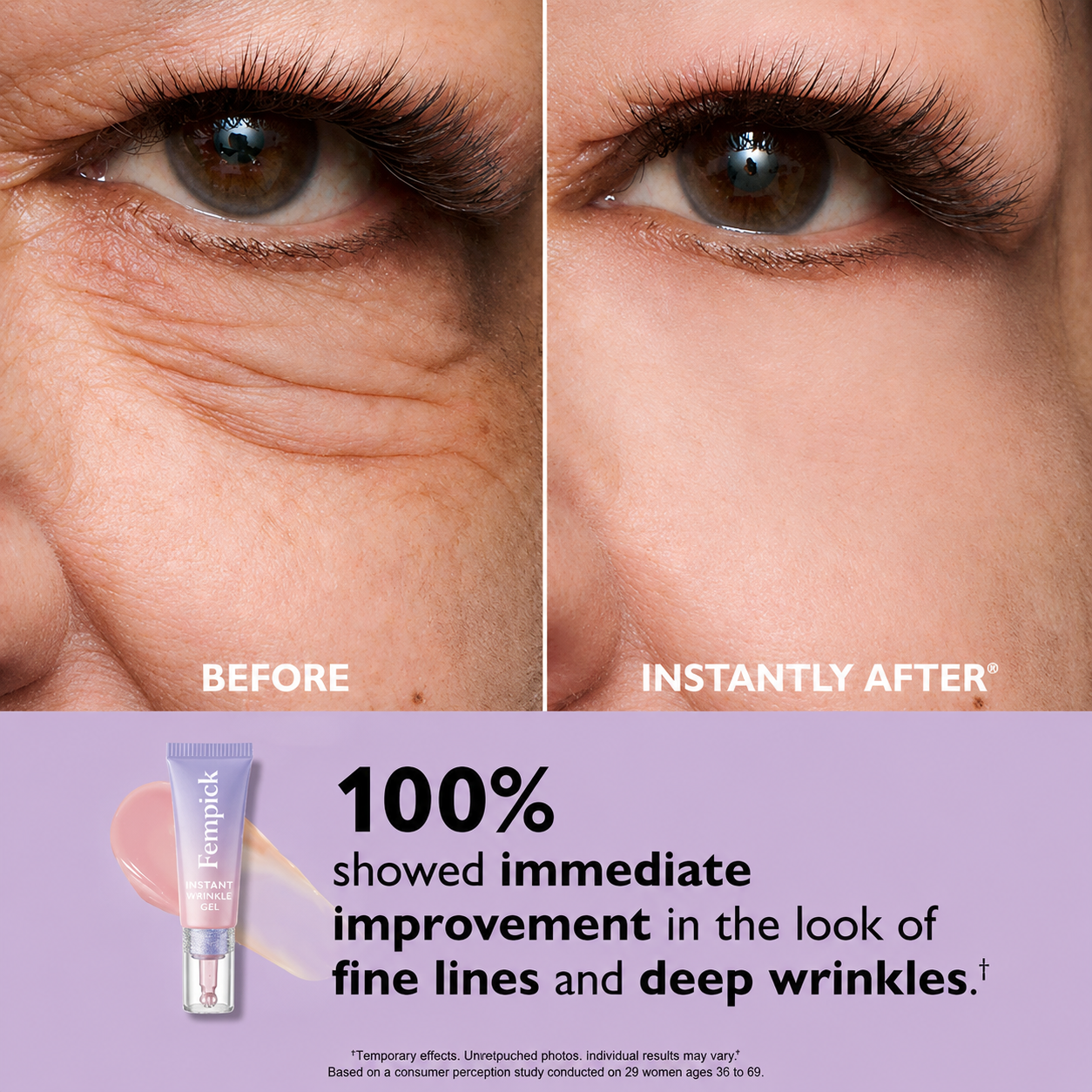 Fempick Eye Bag Instant Eraser, Tightens, Firms, & Blurs Wrinkles