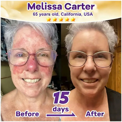 Femscoop® Biotin 10-in-1 Skin Restoration Cream