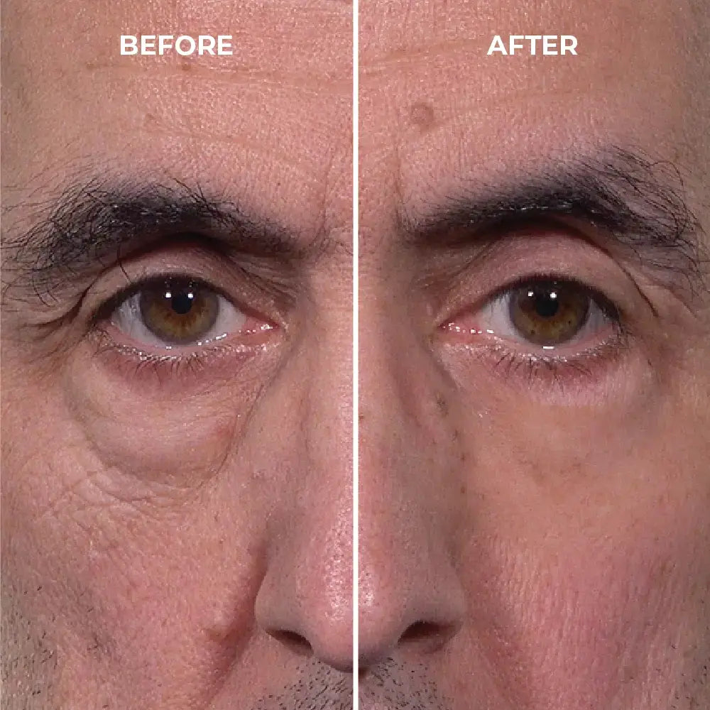 Instantly Erase Heavy Eye Bags & Dark Circles: Look Years Younger in Just 10 Minutes with Femscoop