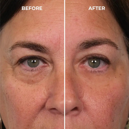 Instantly Erase Heavy Eye Bags & Dark Circles: Look Years Younger in Just 10 Minutes with Femscoop