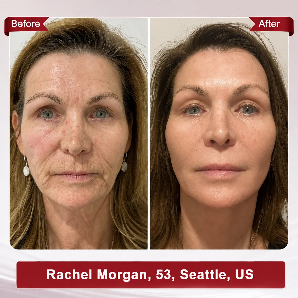 Femscoop Face & Neck Firming Serum | Wrinkle, Elasticity & Pore Care