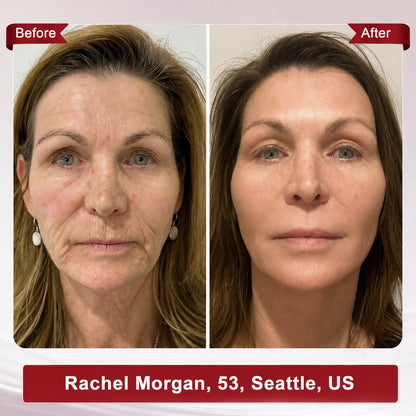 Femscoop Face & Neck Firming Serum | Wrinkle, Elasticity & Pore Care