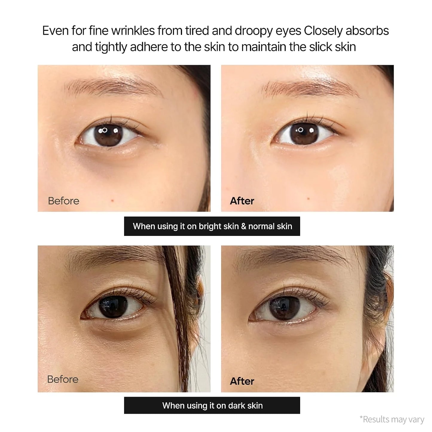 Femscoop Korean Calcium Eye Cream: Visibly Erase Stubborn Dark Spots, Puffy Eye Bags & Dark Circles—Claim Your 50% OFF Today Before It’s Gone!