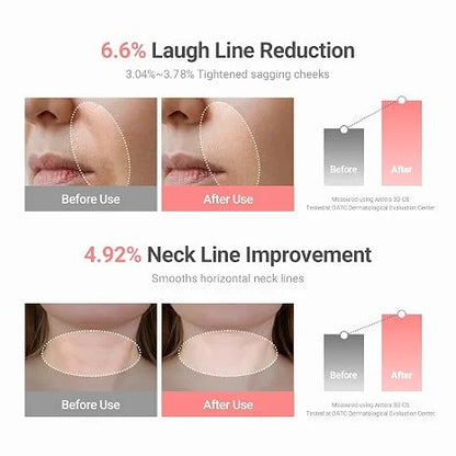 Ladyscart PDRN Collagen Multi-Balm | Advanced Anti-Aging & Total Wrinkle Eraser