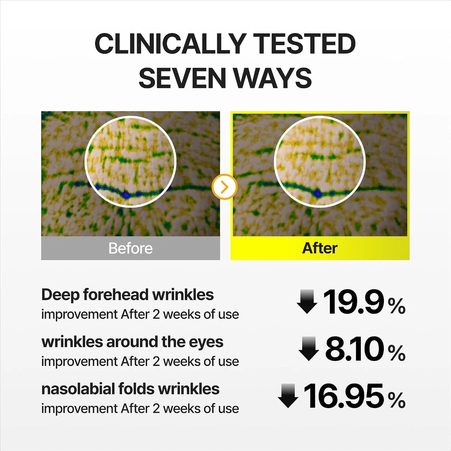 Erase Stubborn Wrinkles & Firm Sagging Skin—Without the Irritation: Femscoop Vita-A Retinal Dual Cream