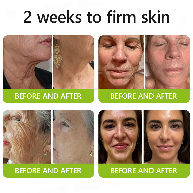 [🔥Last Day 70% OFF]Femscoop™ Botox & Retinol Shot - Eraser for Deep Wrinkles, Sagging Jowls & Puffy Eyes