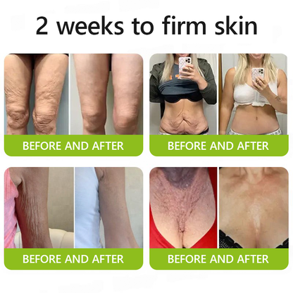 [🔥Last Day 70% OFF]Femscoop™ Botox & Retinol Shot - Eraser for Deep Wrinkles, Sagging Jowls & Puffy Eyes