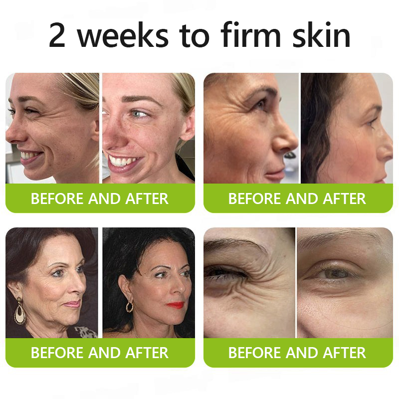 [🔥Last Day 70% OFF]Femscoop™ Botox & Retinol Shot - Eraser for Deep Wrinkles, Sagging Jowls & Puffy Eyes
