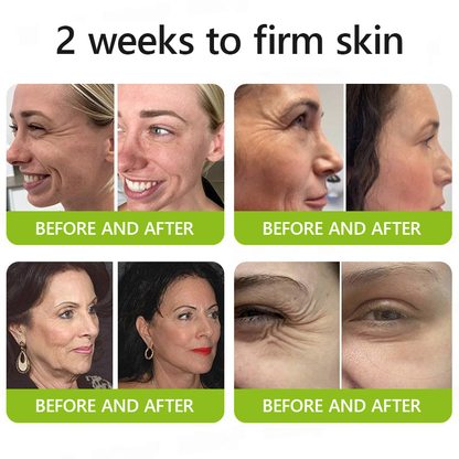 [🔥Last Day 70% OFF]Femscoop™ Botox & Retinol Shot - Eraser for Deep Wrinkles, Sagging Jowls & Puffy Eyes