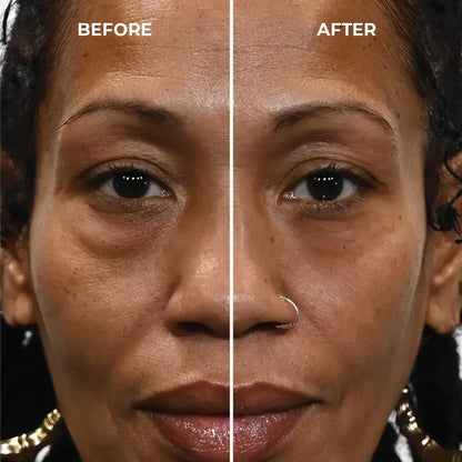 Femscoop Rapid Reduction Serum: Banish Heavy Eye Bags and Fine Lines in 10 Minutes Flat