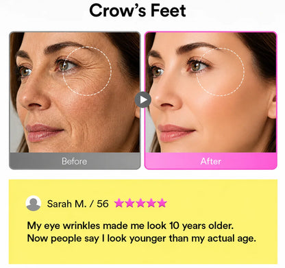 Ladyscart® Eye Care: Maximum Strength Against Bags & Dark Circles, 100% Gentle 🛡️💖