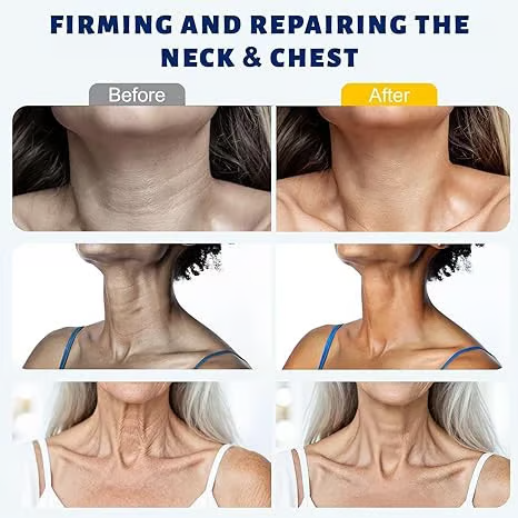 MYLUREN™ Roller Massage Neck Cream 🧴 Collagen & Hyaluronic Acid | Firms Neck, Reduces Wrinkles & Double Chin