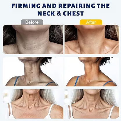 MYLUREN™ Roller Massage Neck Cream 🧴 Collagen & Hyaluronic Acid | Firms Neck, Reduces Wrinkles & Double Chin