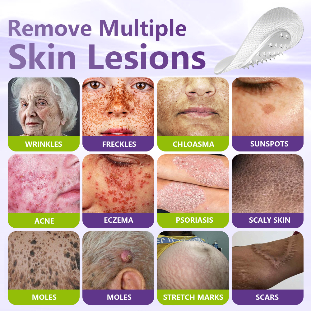 Miretha™Soluble Microneedle Botanical Skin Tag Removal Patch