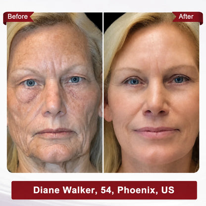 Femscoop Face & Neck Firming Serum | Wrinkle, Elasticity & Pore Care