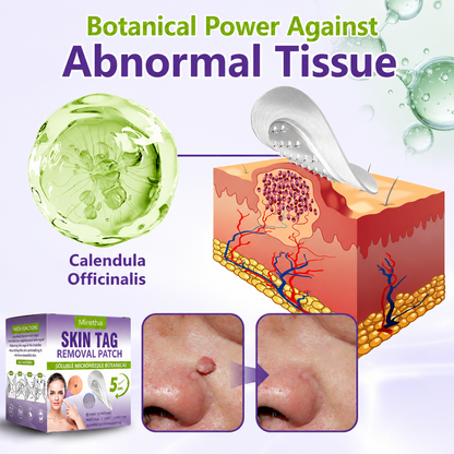 Miretha™Soluble Microneedle Botanical Skin Tag Removal Patch