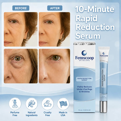 Instantly Erase Heavy Eye Bags & Dark Circles: Look Years Younger in Just 10 Minutes with Femscoop